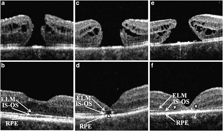 Clicca sull'immagine per ingrandirla

Nome:   eye2011237f1.jpg
Visite: 156
Dimensione:   130.1 KB
ID: 15978